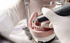Dental Labs 101: A Comprehensive Guide to Dental Prosthetics